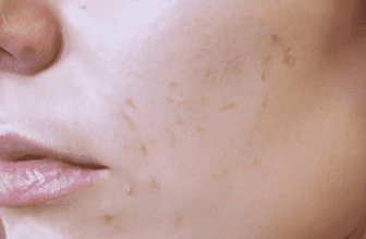 The benefits of exfoliating in a skincare routine