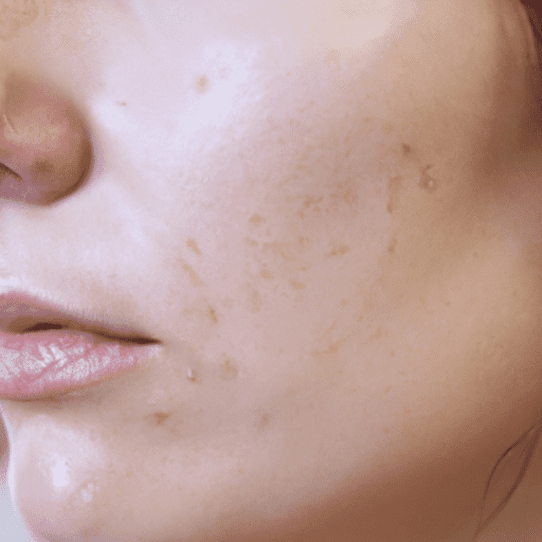 The benefits of exfoliating in a skincare routine