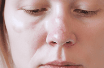 The Impact of Cleansing on Aging Skin