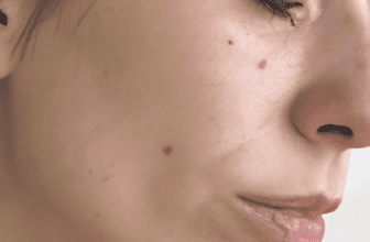 Quick and Easy Skincare Tips