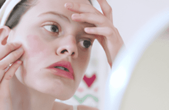 Preventing Acne: Skincare Routines for Clear Skin
