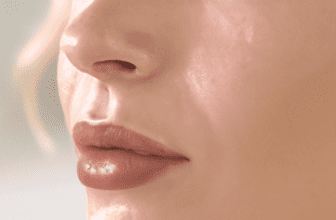a Dermatologist Guide to Skincare for Oily Skin