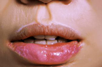 Fact or Fiction: Can You Shrink Your Pores?