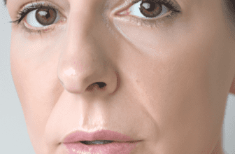 Achieving Clear Skin: Insights from a Dermatologist