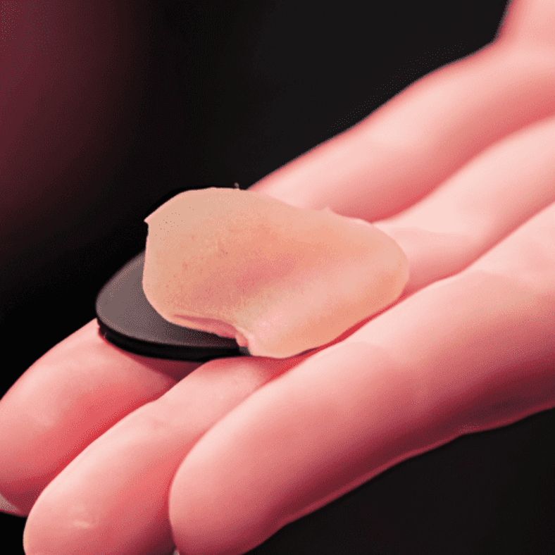 Treating Acne: Avoid the Cookie Cutter Approach