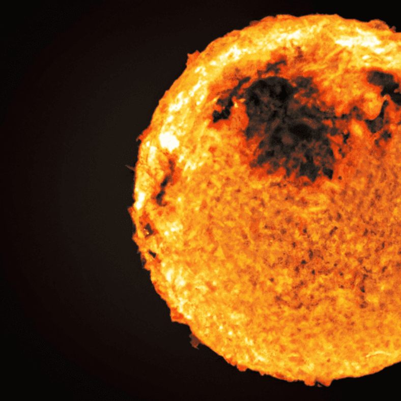 The Causes of Skin Cancer: Beyond the Sun