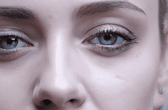 Identifying common skin concerns