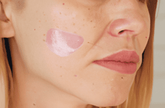 How to Fade Hyperpigmentation