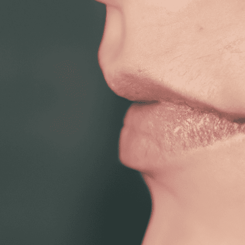 Understanding Common Skin Growths