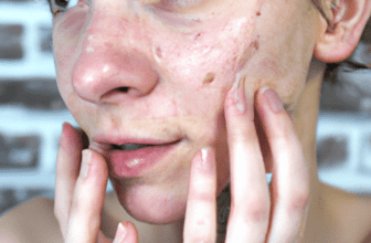 The Importance of Consistency in Skincare Routines