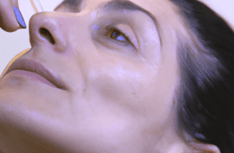 Tips for Preventing and Treating Acne