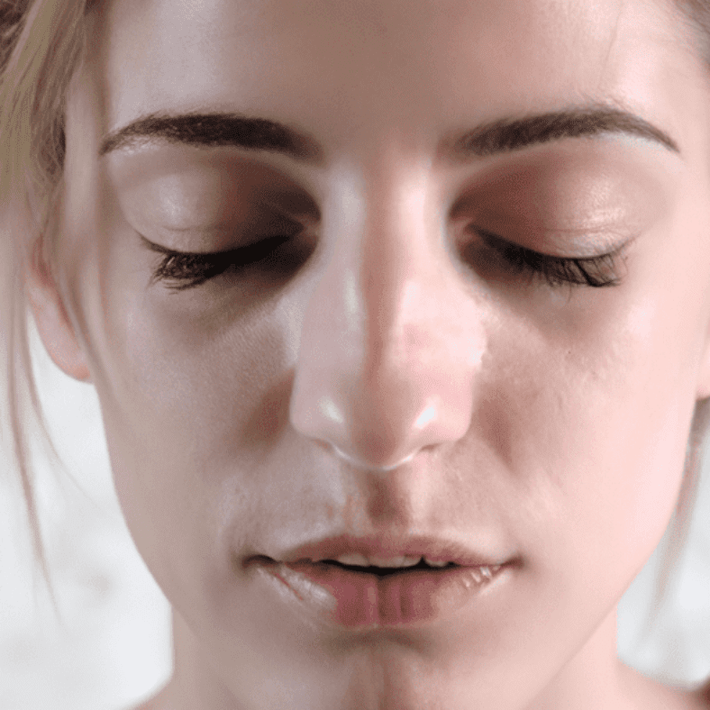 Understanding Melasma: A Complete Overview