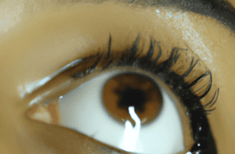 Lifestyle Changes to Reduce Hyperpigmentation