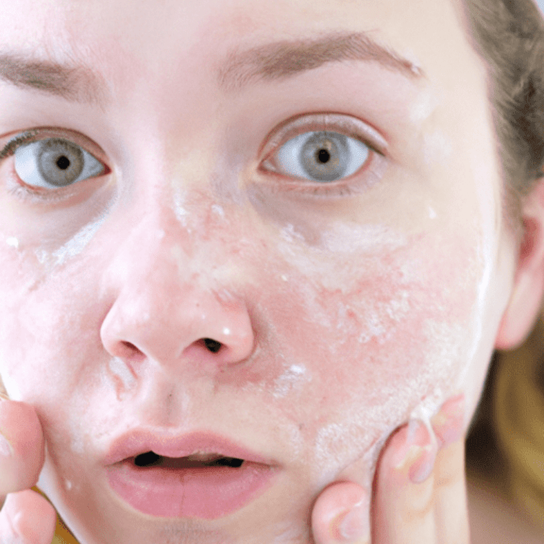 The Role of Stress in Skincare Routines