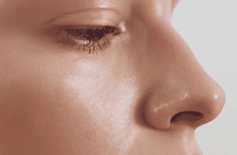 How to Improve Skin Elasticity